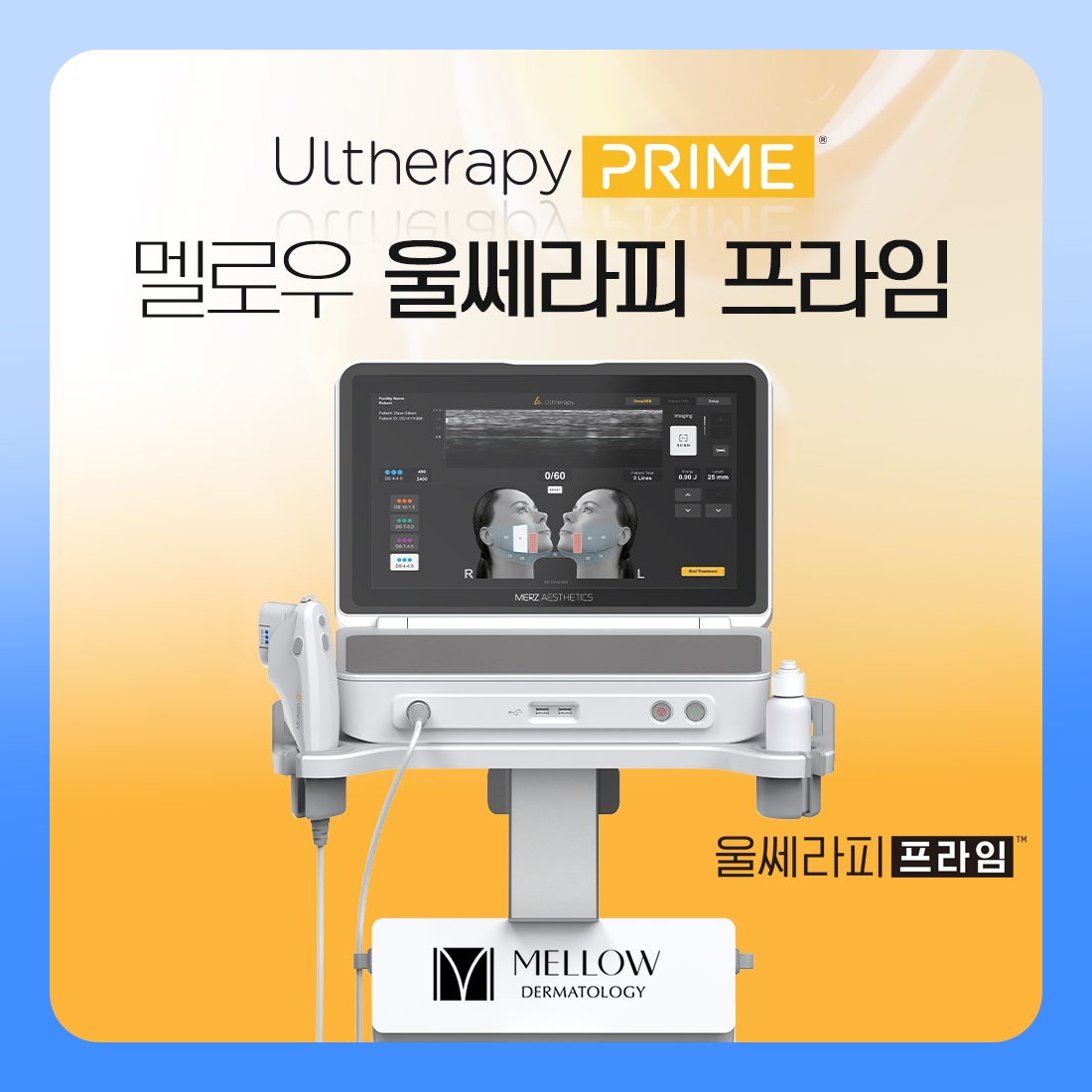 울쎄라피 프라임, 이전 장비와 무엇이 달라졌을까요 멜로우피부과 공덕점